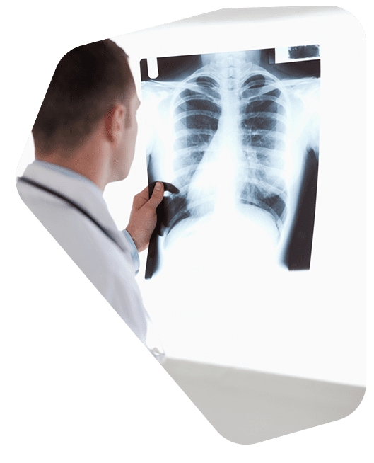 precio-de-estudio-de-tuberculosis.png